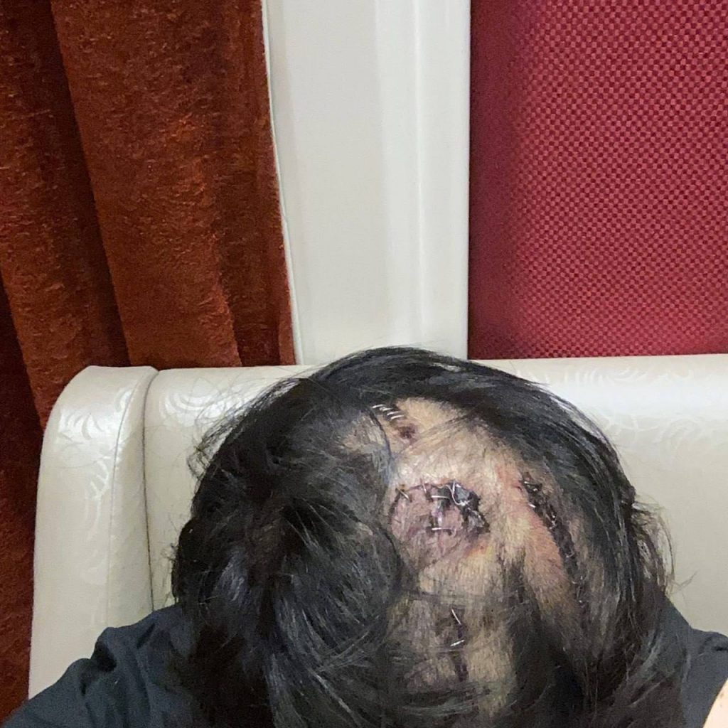 韓國男子在馬尼拉被綁架虐待後求救無門