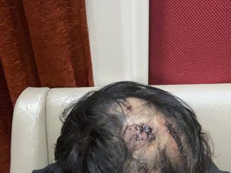 韓國男子在馬尼拉被綁架虐待後求救無門