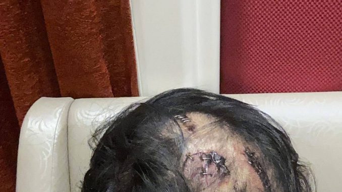 韓國男子在馬尼拉被綁架虐待後求救無門