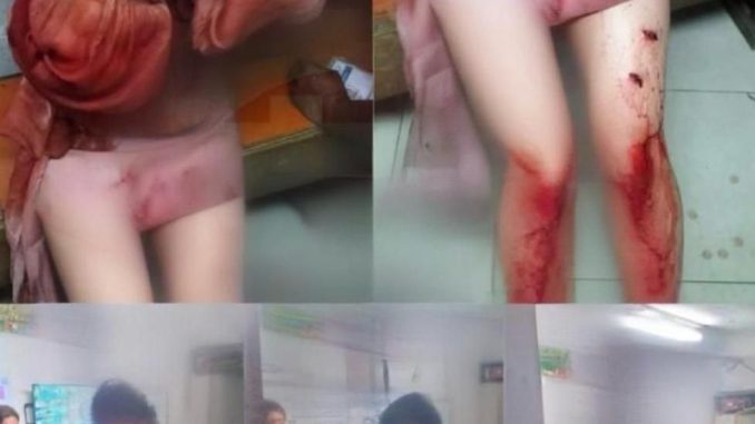 越南女子在菲律賓帕拉尼亞克遭遇惡性持刀搶劫