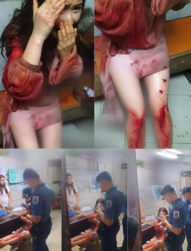 越南女子在菲律賓帕拉尼亞克遭遇惡性持刀搶劫