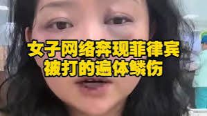 中國女子赴菲律賓見網戀男友慘遭毒打後連夜回國